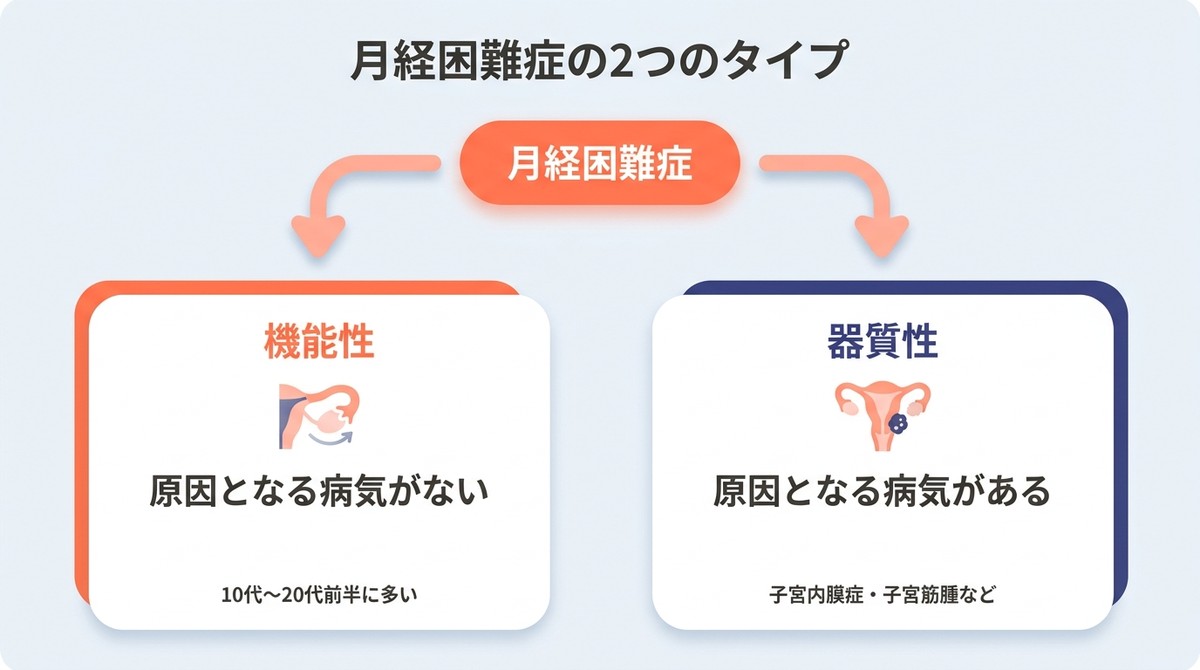 月経困難症の2つのタイプ(機能性・器質性)の違いを整理した図