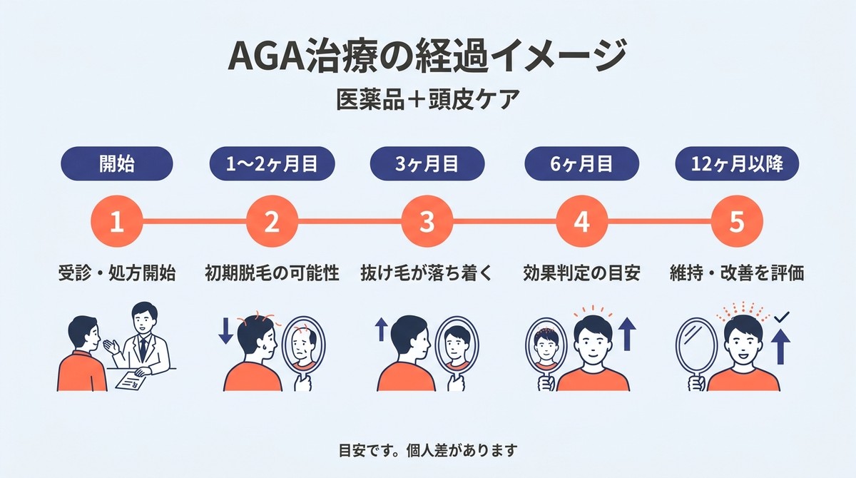 AGA治療開始から12ヶ月以降までの治療経過を示す横軸タイムライン図(AGA シャンプー)