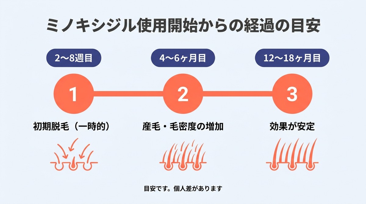 ミノキシジルの効果が現れるまでのタイムライン。2〜8週目の初期脱毛、4〜6ヶ月目の改善実感、12〜18ヶ月目の効果安定